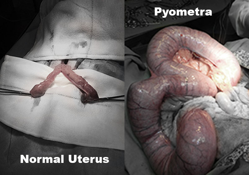 Normal Uterus and Pyometra